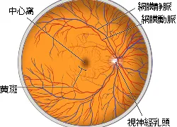 糖尿病網膜症とは？